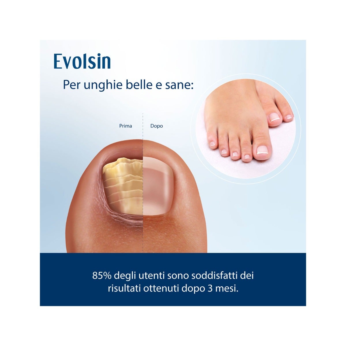 Evolsin Liquide Antifongique pour Ongles 10 ml