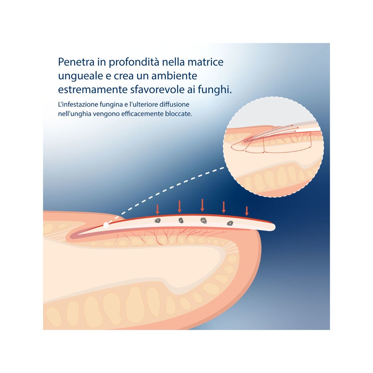 Evolsin Liquide Antifongique pour Ongles 10 ml