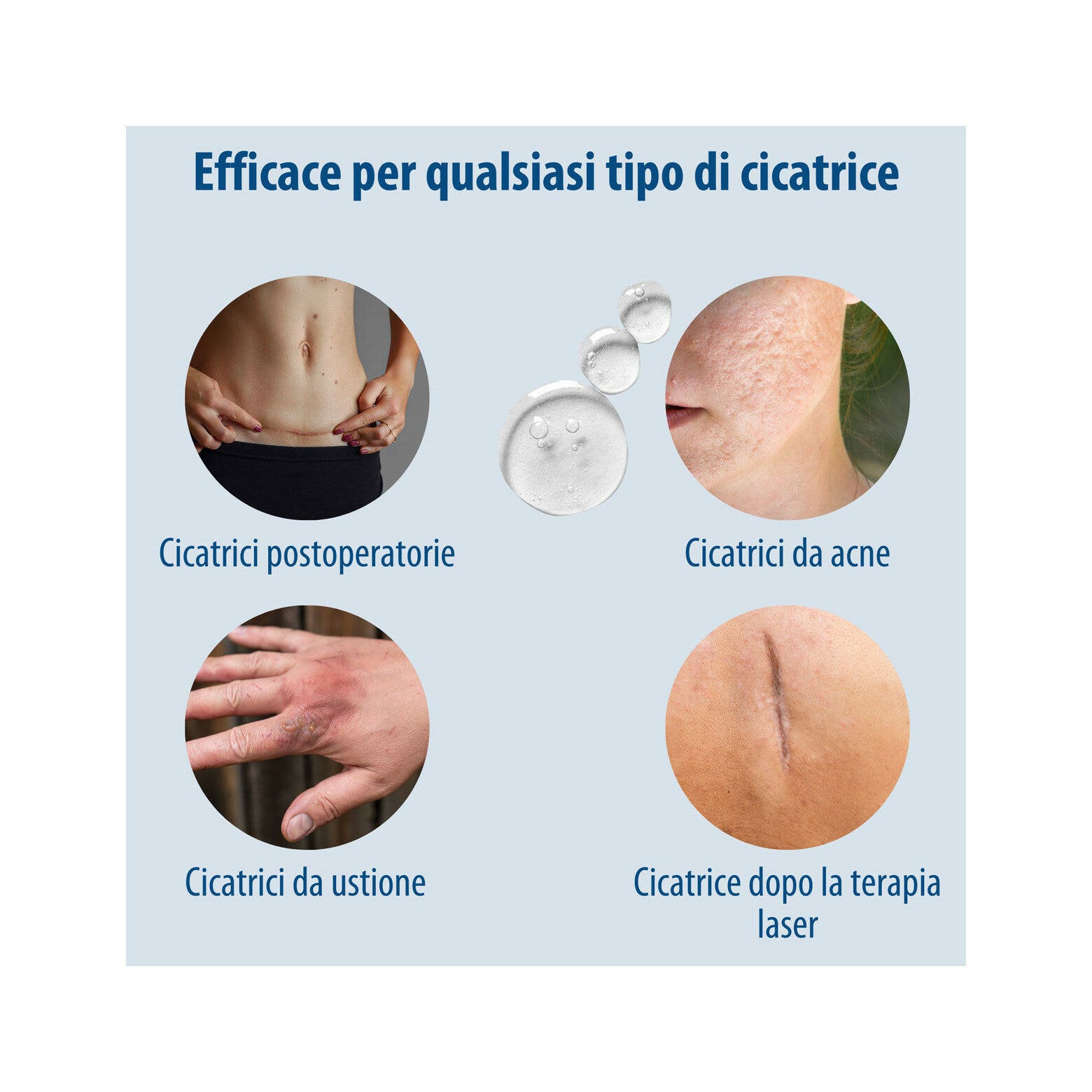 Evolsin Gel au silicone pour cicatrices pour enfants et adultes 20 g