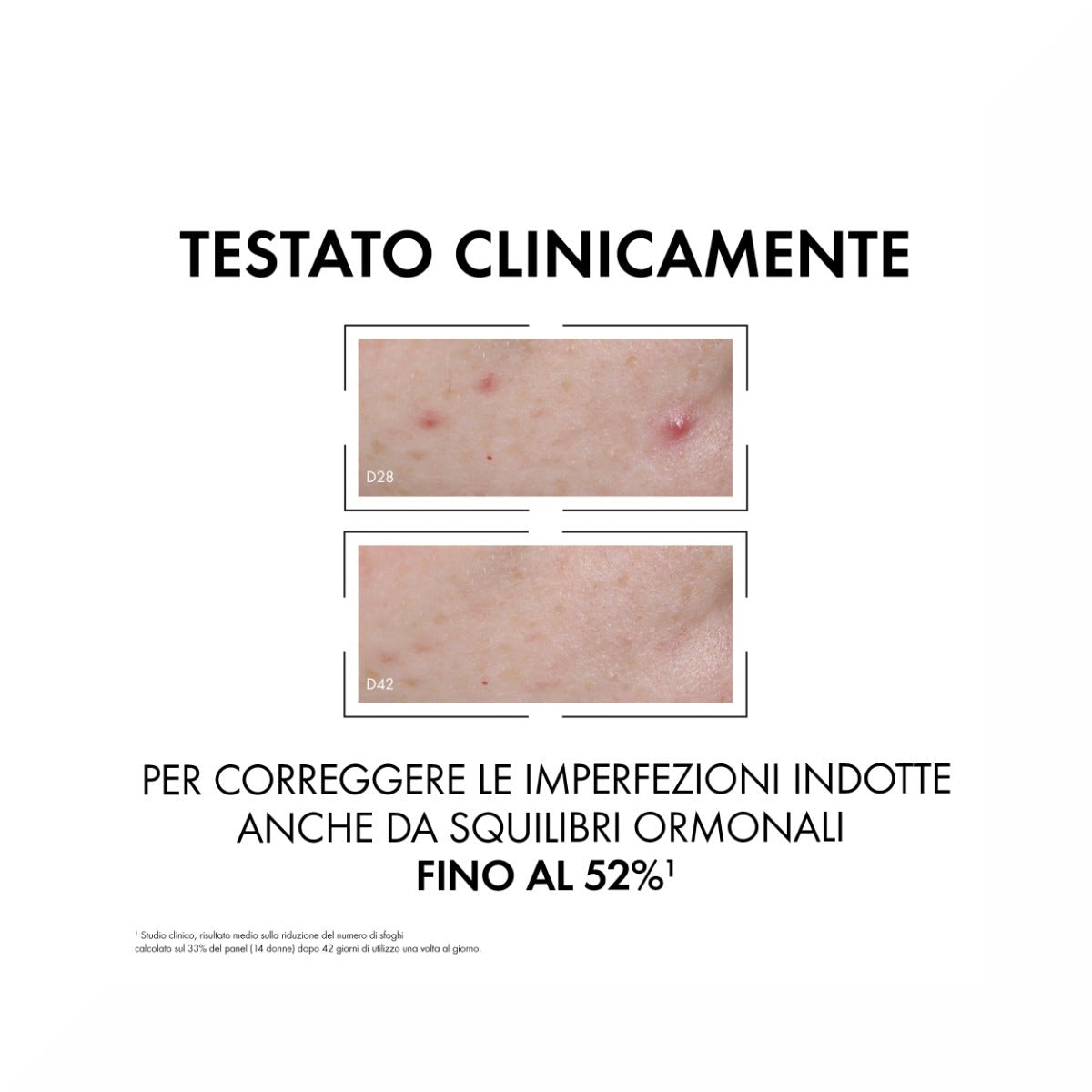 Vichy Normaderm Probio - BHA Sérum Anti-Imperfections 30 ml