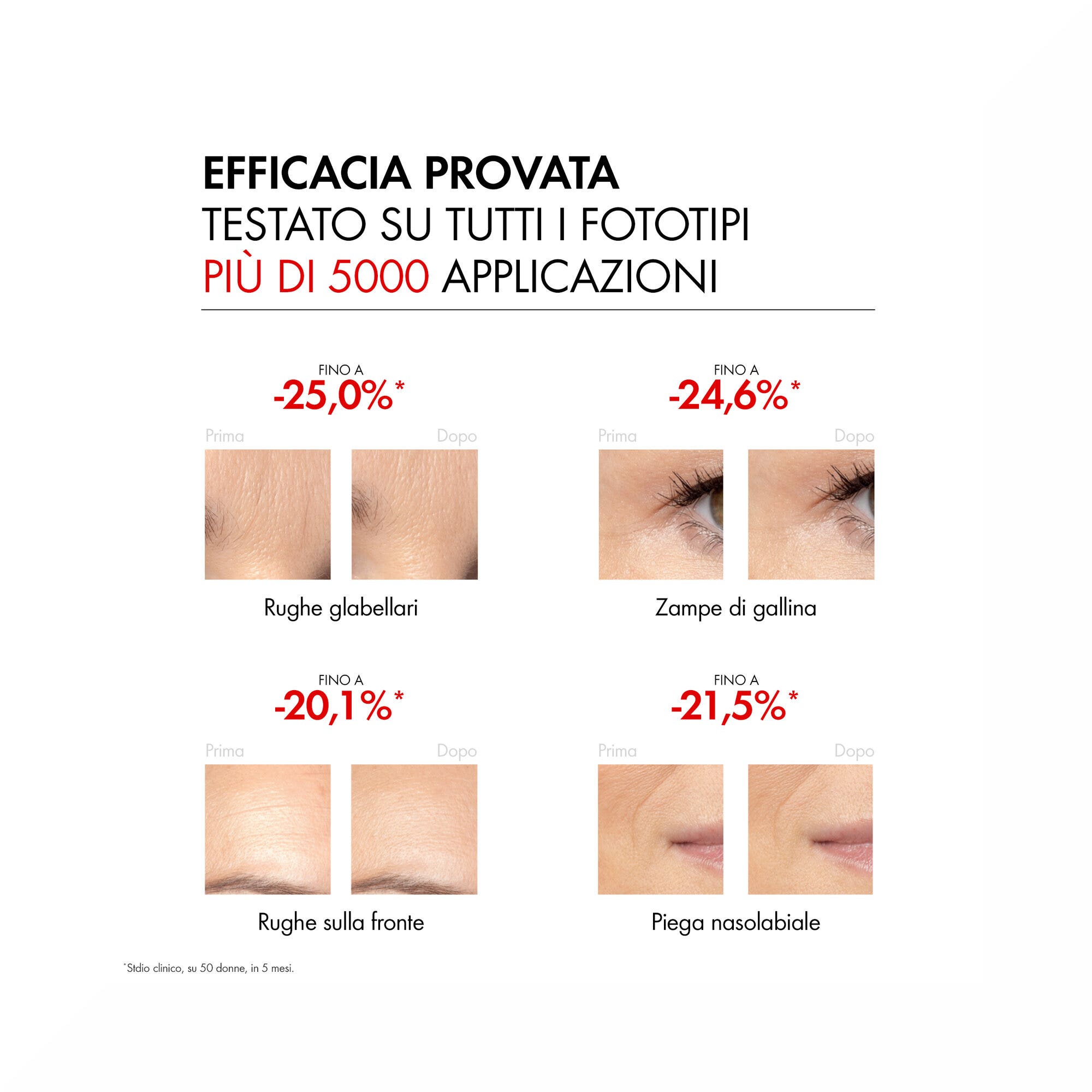 Vichy Retinol Specialist Sérum Corrige les rides, même profondes 30 ml