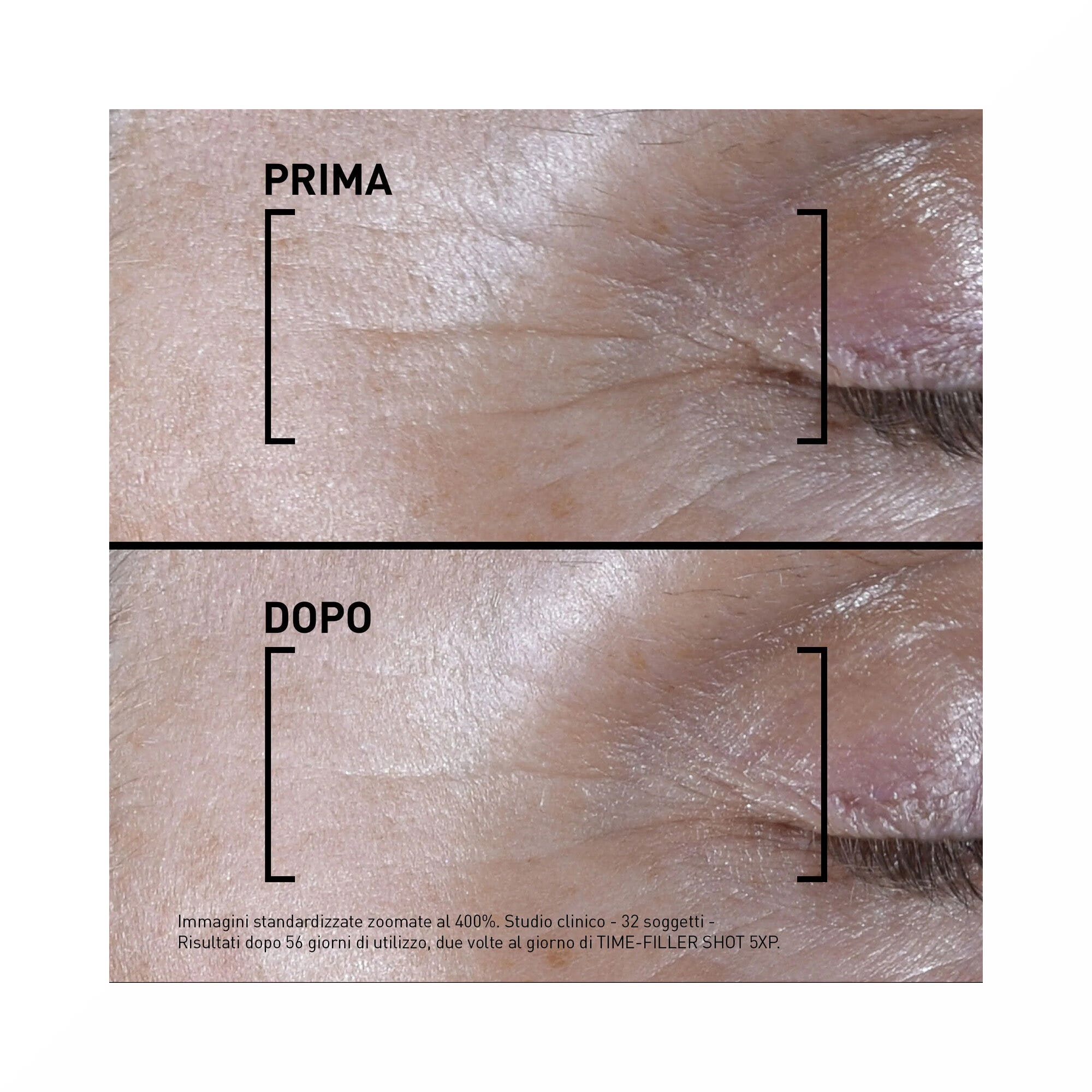 Filorga Time Filler Shot 5xp Siero Concentrato Linee Di Espressione 15ml
