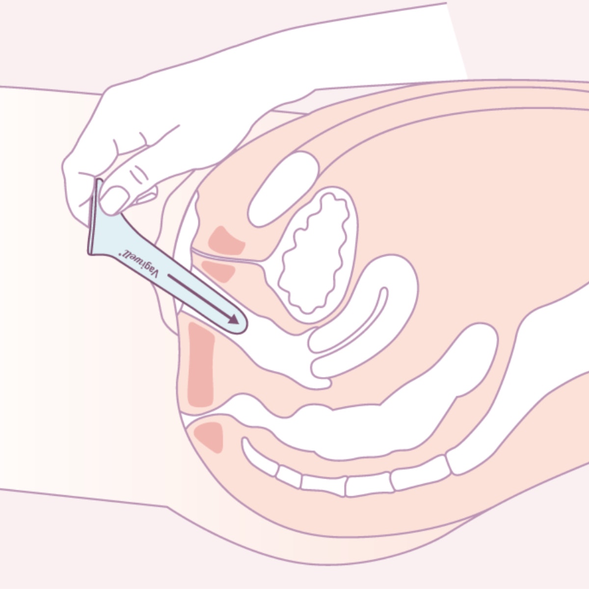 Vagiwell Dilatateur vaginal taille 5