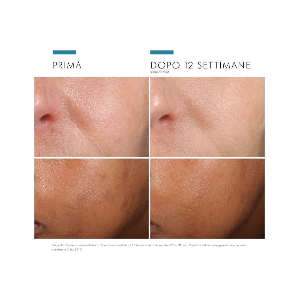 SkinCeuticals Phloretin CF Siero Antiossidante per Pelli Iperpigmentate con 10% di Vitamina C Pura 30ml