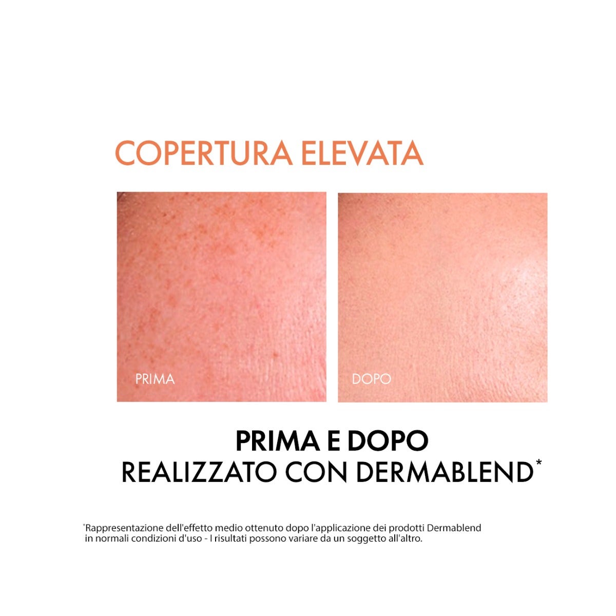 Vichy Dermablend Fond de teint fluide couvrant teinte 45 30 ml SPF35