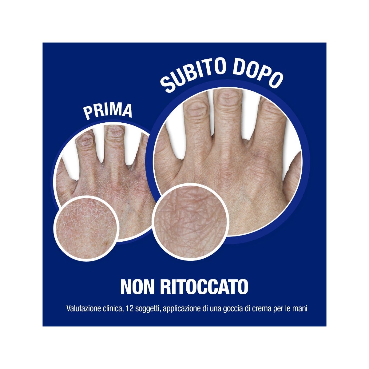 Vetrap Bande élastique rouge 5 cm