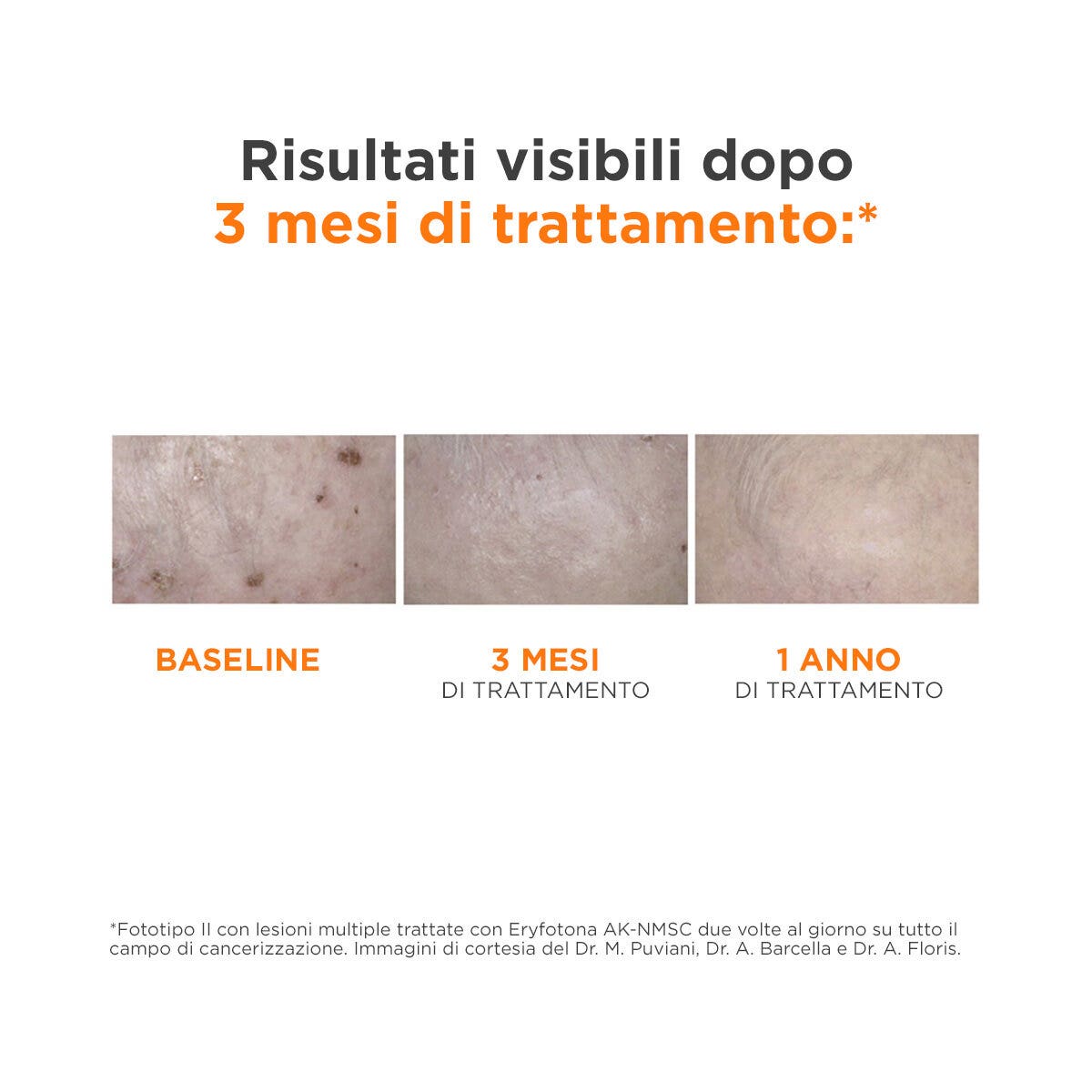 Isdin Eryfotona AK-NMSC Fluid SPF100+ 50ml - Protezione Solare