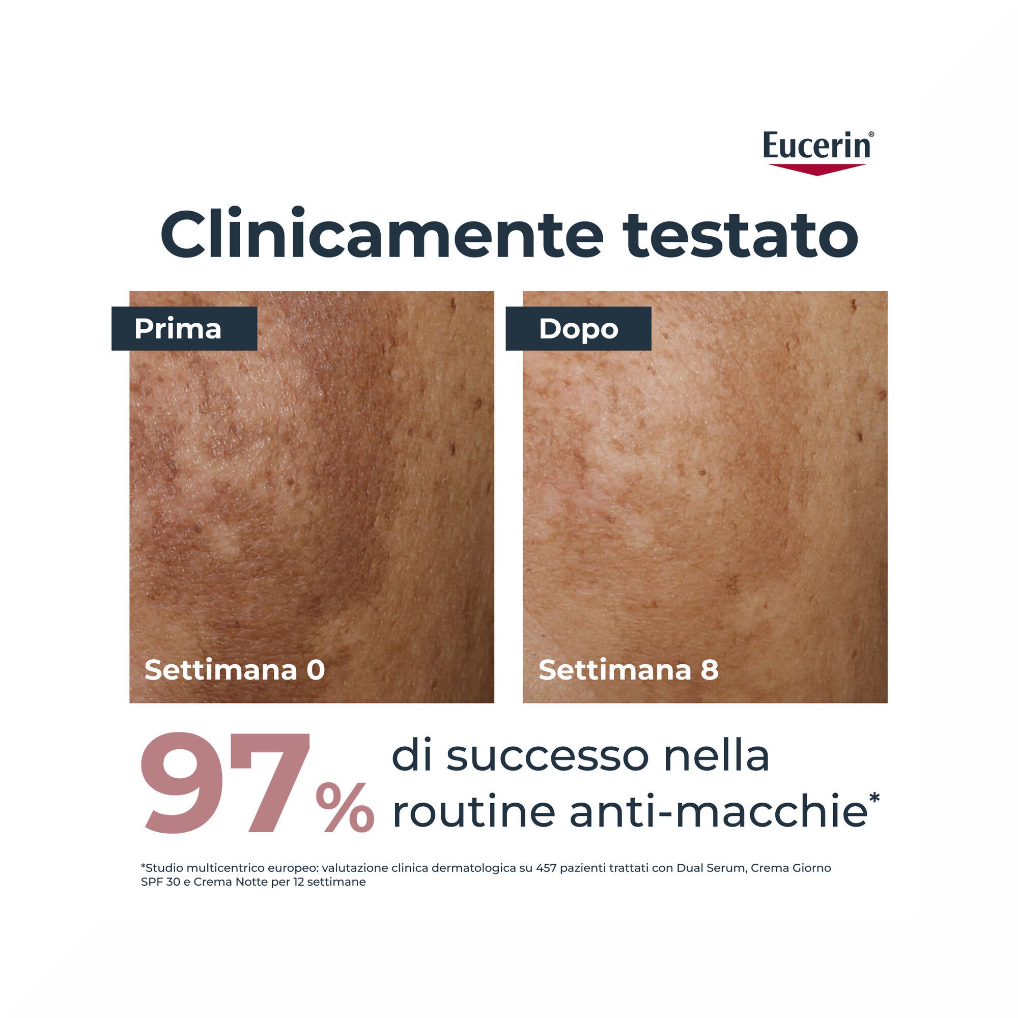 Eucerin Anti-Pigment Dual Serum 30 ml