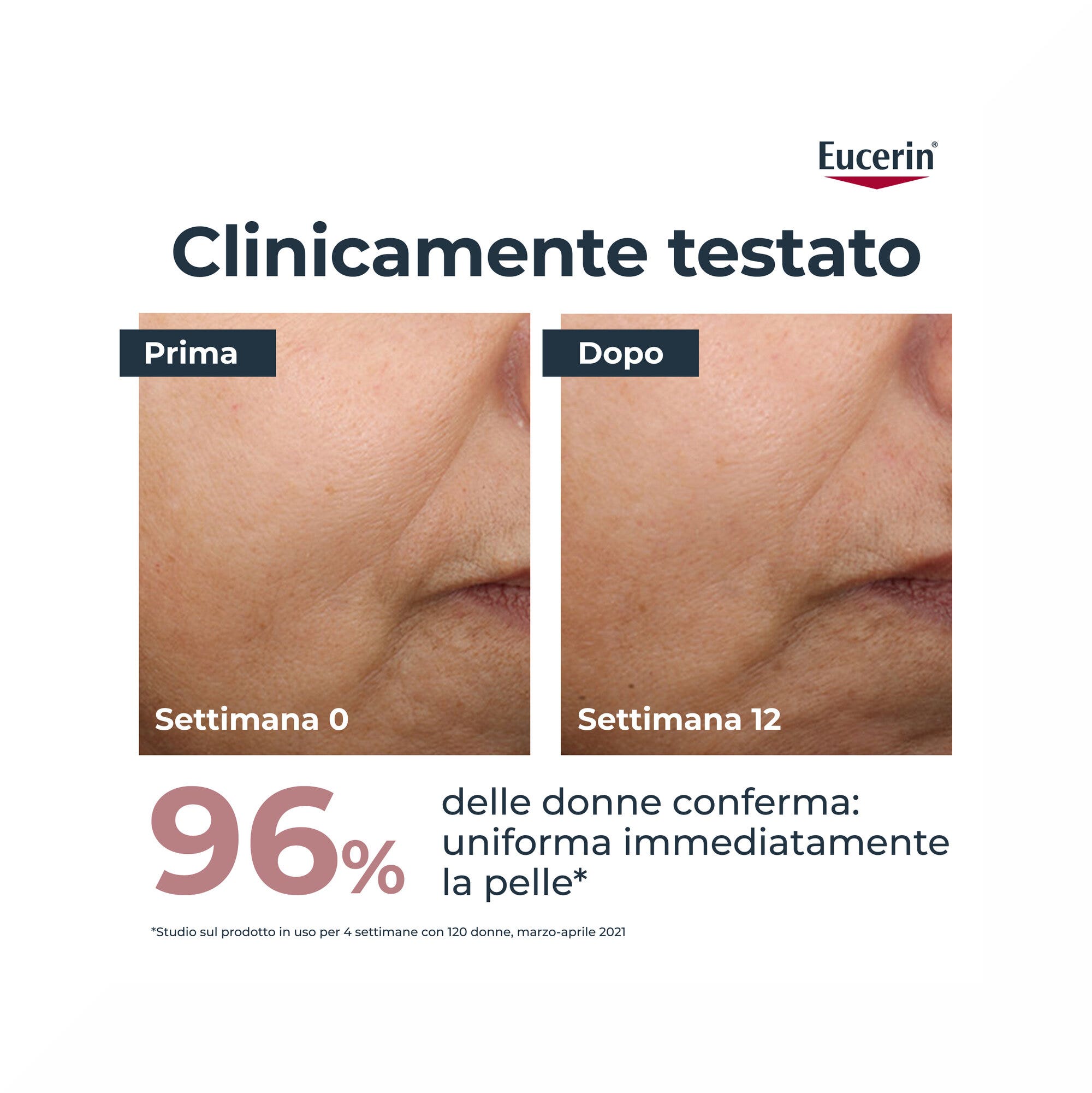 Eucerin Anti-Pigment Crème de Jour SPF 30 Teintée Medium 30 ml