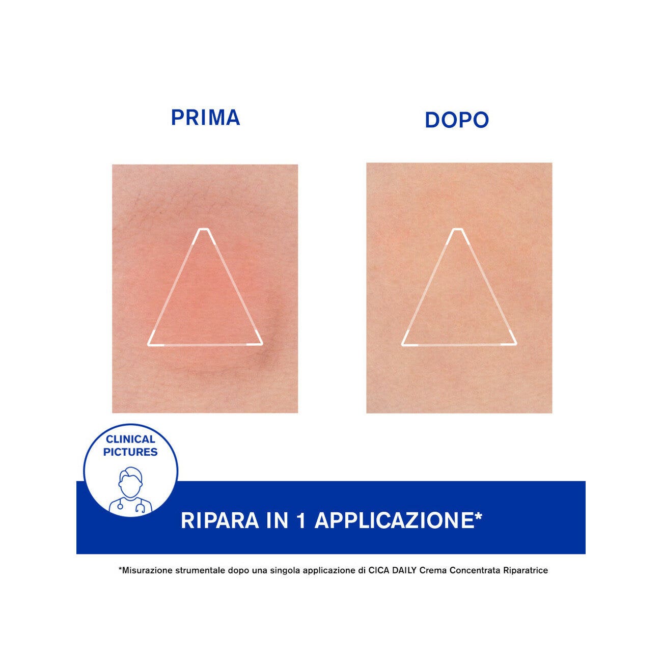 Uriage Cica Daily Crema Concentrata Riparatrice 50ml