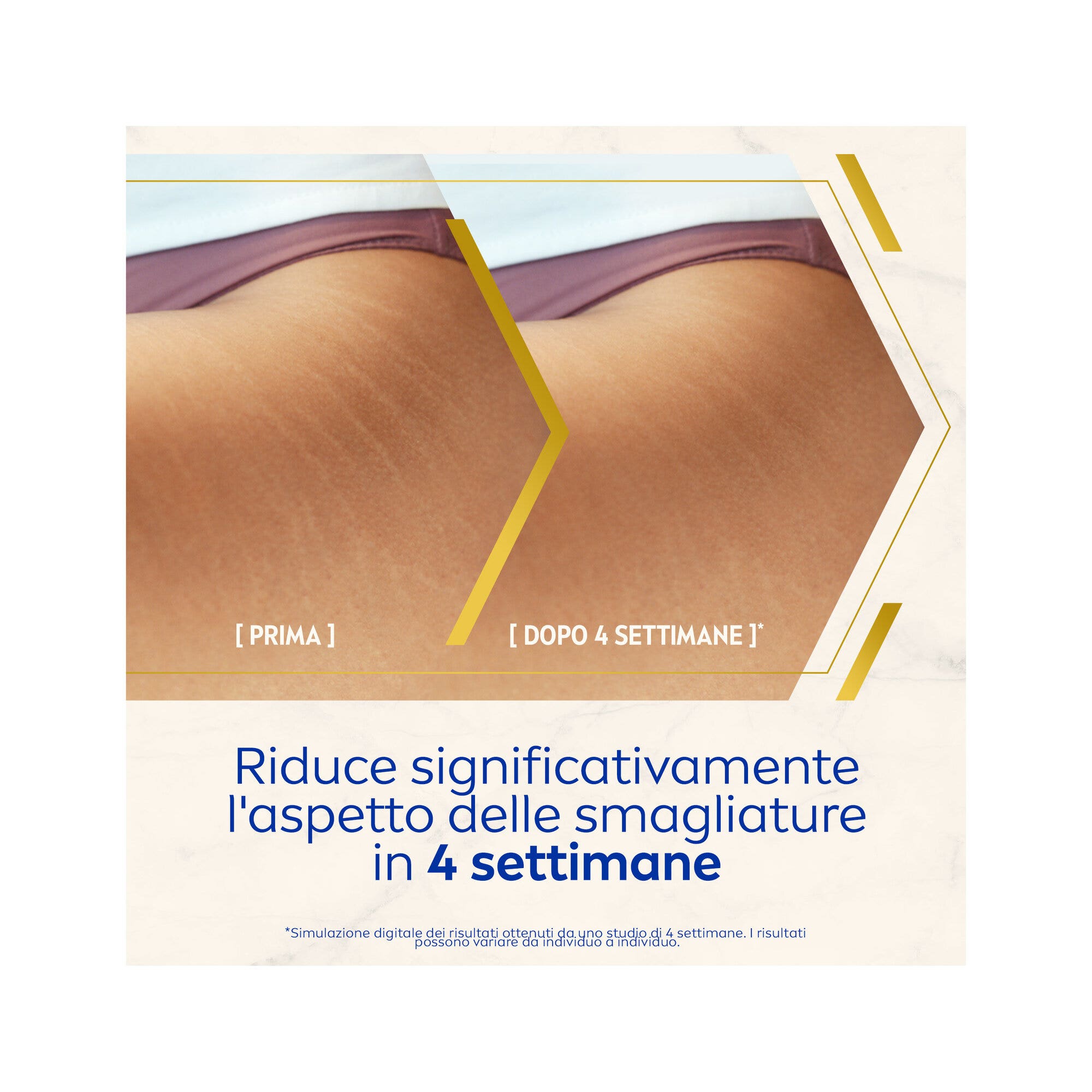 Nivea Luminous630 Olio-siero Corpo Antismagliature Per La Cura Corpo 100ml